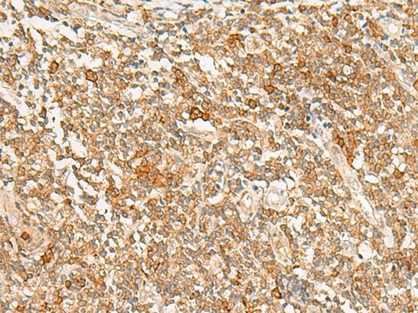 JPT1 Polyclonal Antibody (E-AB-18906)