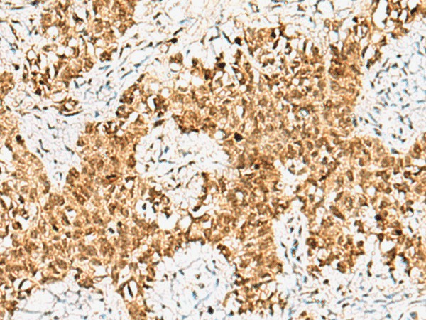 CRCP Polyclonal Antibody (E-AB-52562)