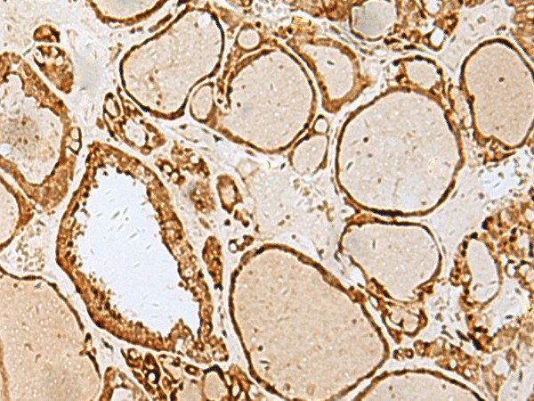 LYRM1 Polyclonal Antibody (E-AB-52800)