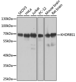 KHDRBS1 Polyclonal Antibody (E-AB-62359)