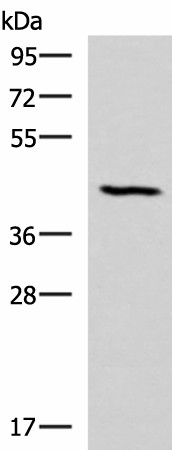 SMPD2 Polyclonal Antibody (E-AB-52945)