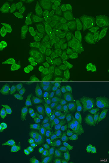 DPM1 Polyclonal Antibody (E-AB-62982)