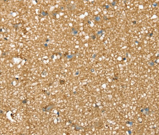 SDC3 Polyclonal Antibody (E-AB-16897)