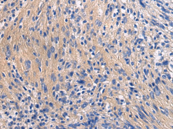 GALR3 Polyclonal Antibody (E-AB-19894)