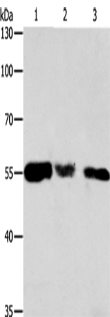 CALR Polyclonal Antibody (E-AB-14113)