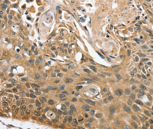 RBM38 Polyclonal Antibody (E-AB-16755)