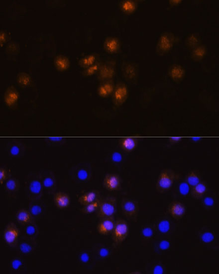 SWAP70 Polyclonal Antibody (E-AB-65133)