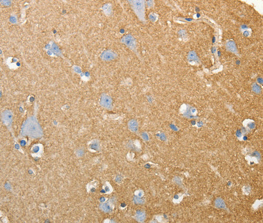 SLC4A4 Polyclonal Antibody (E-AB-14348)