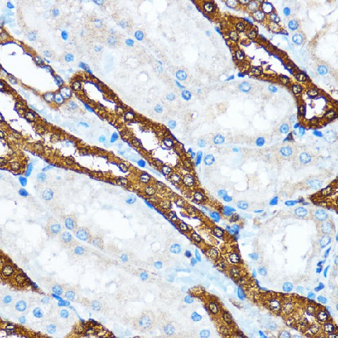 PIK3CA Polyclonal Antibody (E-AB-60054)