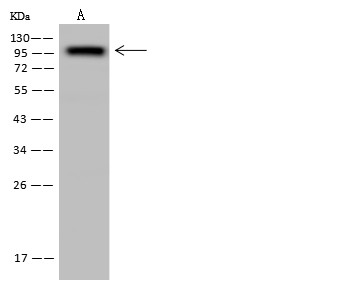 CD10 Monoclonal Antibody (AN200185P)