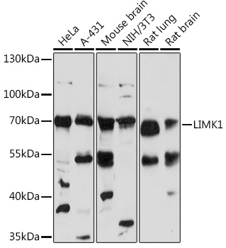 LIMK1 Polyclonal Antibody (E-AB-93157)