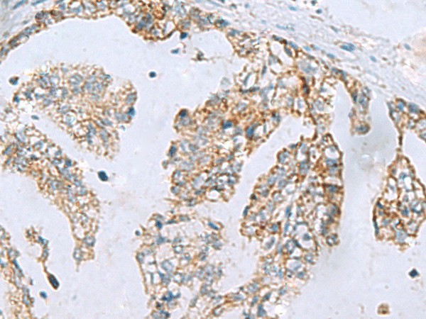 MGME1 Polyclonal Antibody (E-AB-19238)