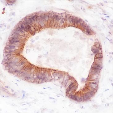 Recombinant FGFR2 Monoclonal Antibody (AN301522L)