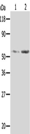 AKR1B1 Polyclonal Antibody (E-AB-10037)