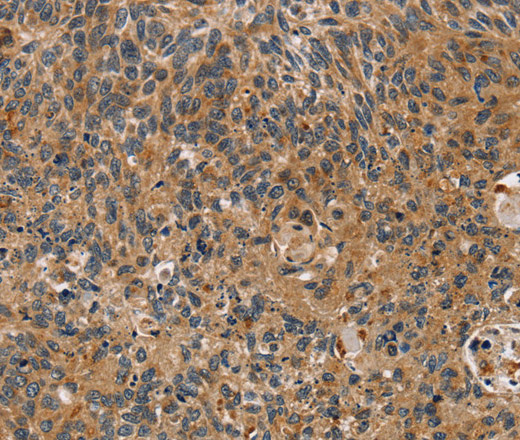 TAC1 Polyclonal Antibody (E-AB-14247)