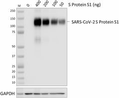 Purified anti-SARS-CoV-2 S Protein S1 Antibody (944401)