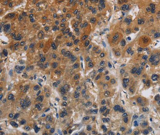 Claudin 8 Polyclonal Antibody (E-AB-12457)
