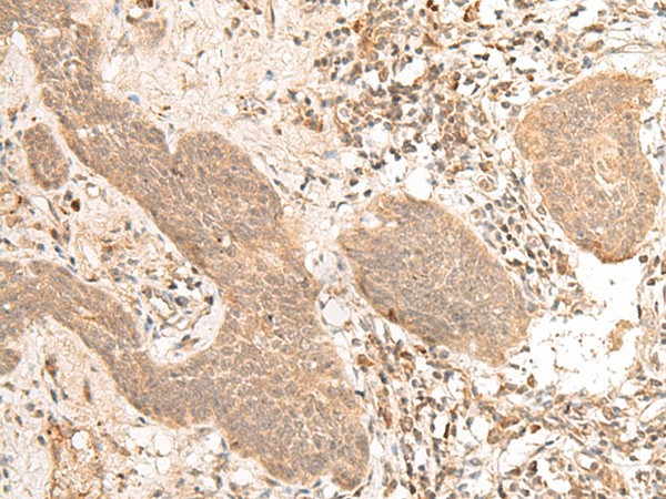 FIZ1 Polyclonal Antibody (E-AB-19871)