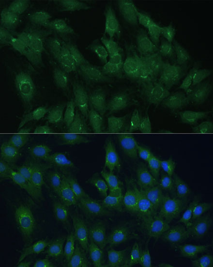 ARL1 Polyclonal Antibody (E-AB-65234)