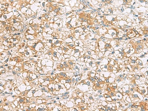TLE6 Polyclonal Antibody (E-AB-52751)