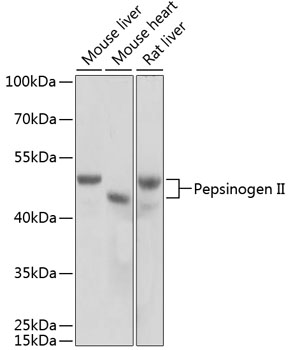 Pepsinogen II Polyclonal Antibody (E-AB-60782)