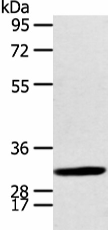 CALB2 Polyclonal Antibody (E-AB-19373)