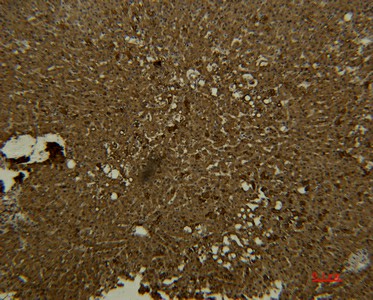 Transferrin Monoclonal Antibody (E-AB-22192)