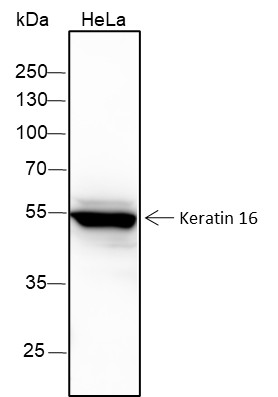Recombinant Keratin 16 Monoclonal Antibody (AN301575L)