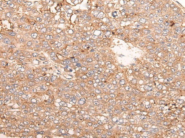 SIGLECL1 Polyclonal Antibody (E-AB-17748)