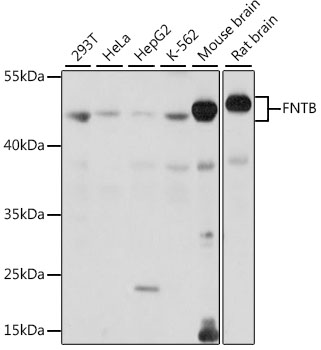 FNTB Polyclonal Antibody (E-AB-91238)