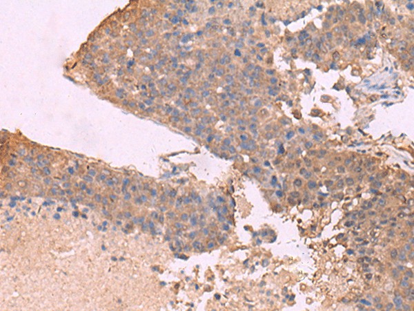 KCNU1 Polyclonal Antibody (E-AB-18173)