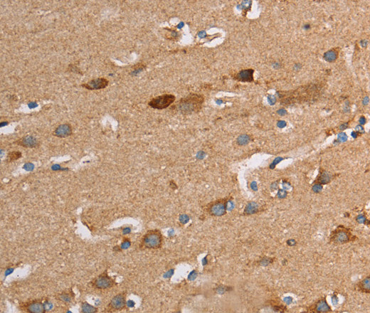 TLR8 Polyclonal Antibody (E-AB-13839)