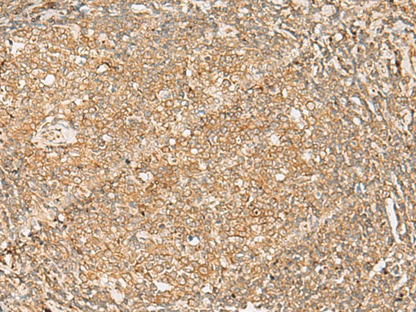 FNTB Polyclonal Antibody (E-AB-52750)