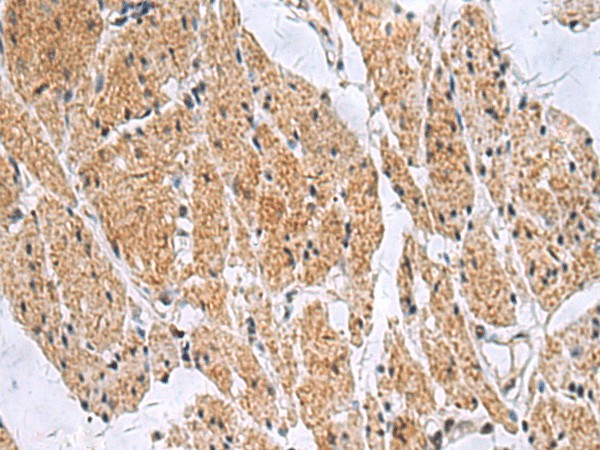 SLC4A3 Polyclonal Antibody (E-AB-53420)