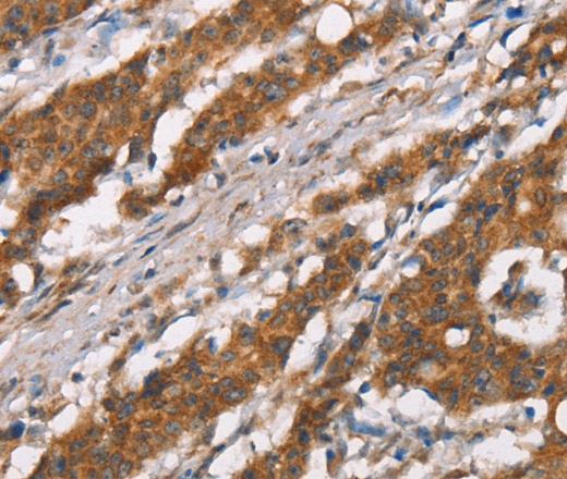 DSC2 Polyclonal Antibody (E-AB-13194)