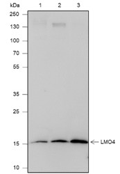 Recombinant LMO4 Monoclonal Antibody (AN301825L)