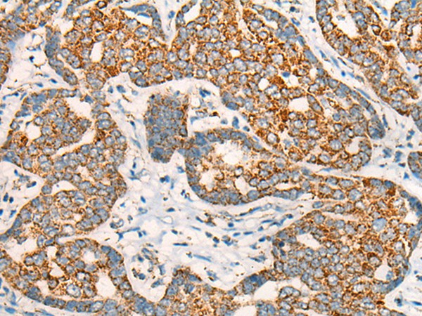 CCT8L2 Polyclonal Antibody (E-AB-18611)