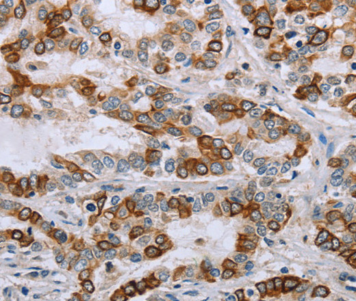 NMT1 Polyclonal Antibody (E-AB-13461)