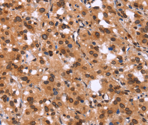 GPR124 Polyclonal Antibody (E-AB-13277)