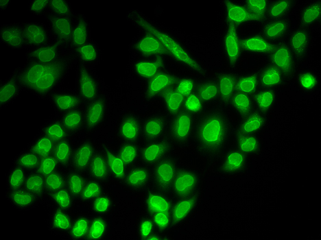 RANGAP1 Polyclonal Antibody (E-AB-64572)