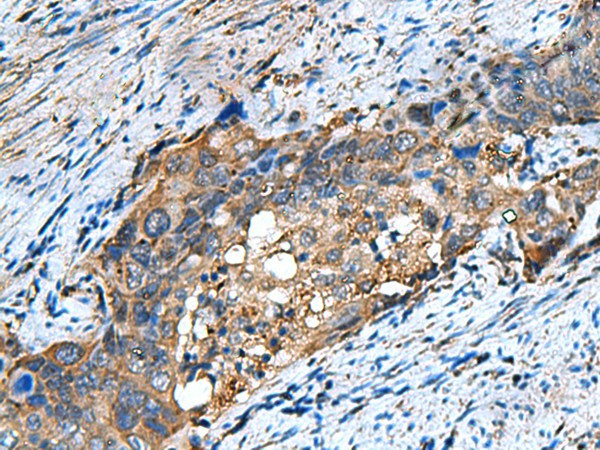COMMD9 Polyclonal Antibody (E-AB-19159)