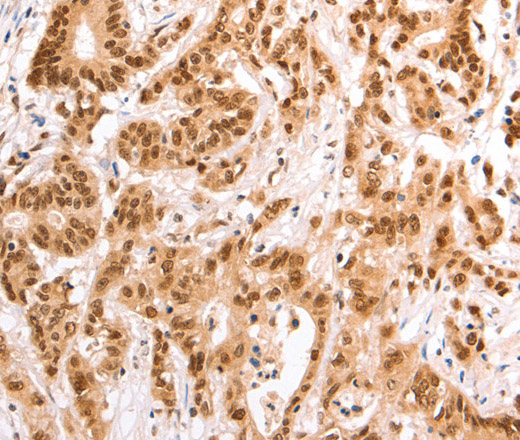 TAX1BP1 Polyclonal Antibody (E-AB-10657)