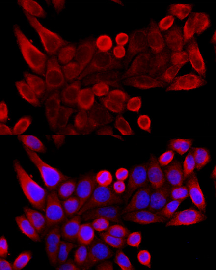VDAC3 Polyclonal Antibody (E-AB-64061)