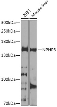 NPHP3 Polyclonal Antibody (E-AB-92891)