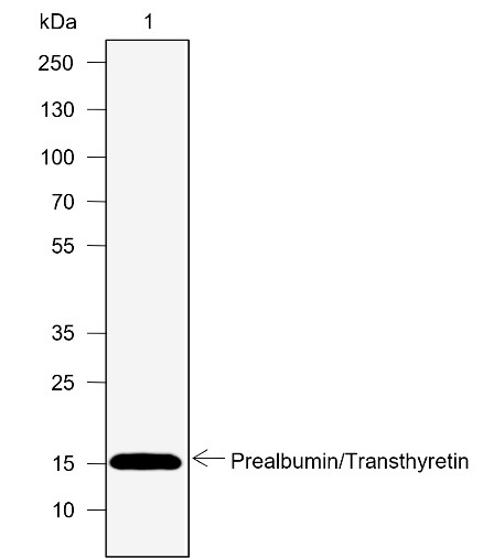Recombinant Prealbumin/Transthyretin Monoclonal Antibody (AN302048L)