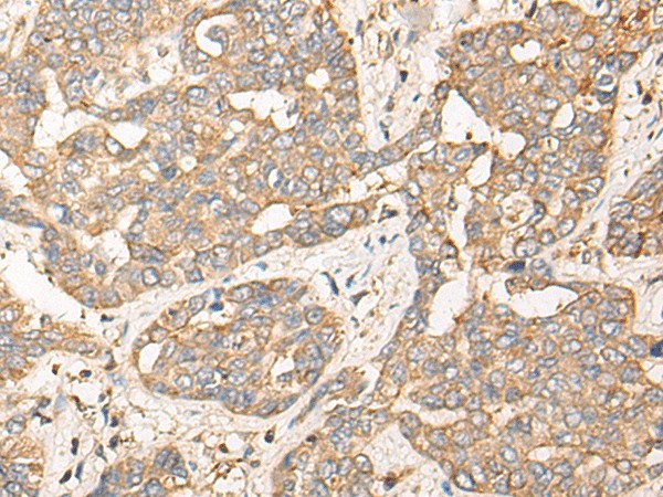 CPNE3 Polyclonal Antibody (E-AB-18628)