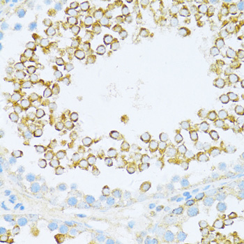 DVL1 Polyclonal Antibody (E-AB-64060)