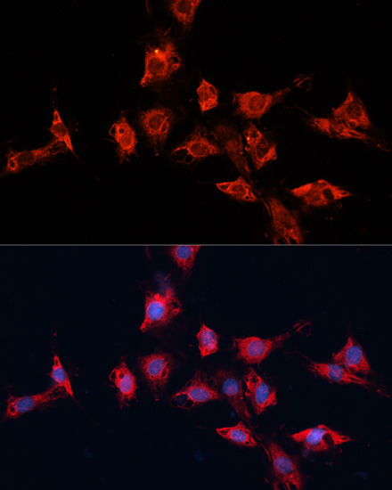 ADAM11 Polyclonal Antibody (E-AB-66261)