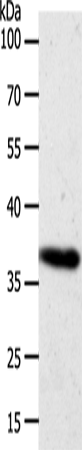 AKR1B1 Polyclonal Antibody (E-AB-12709)