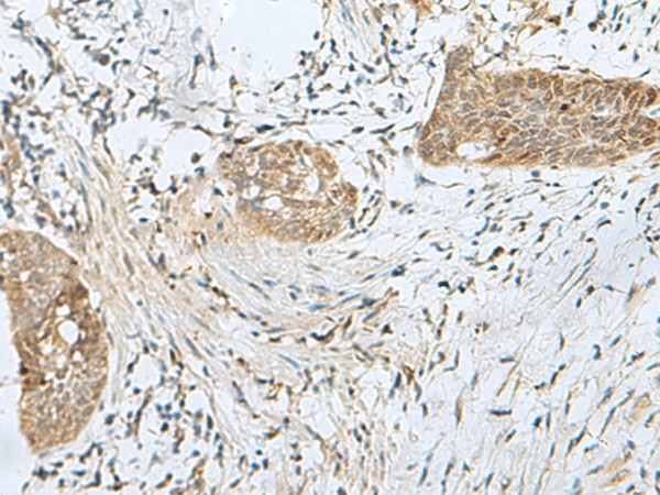 SNRPD1 Polyclonal Antibody (E-AB-18884)